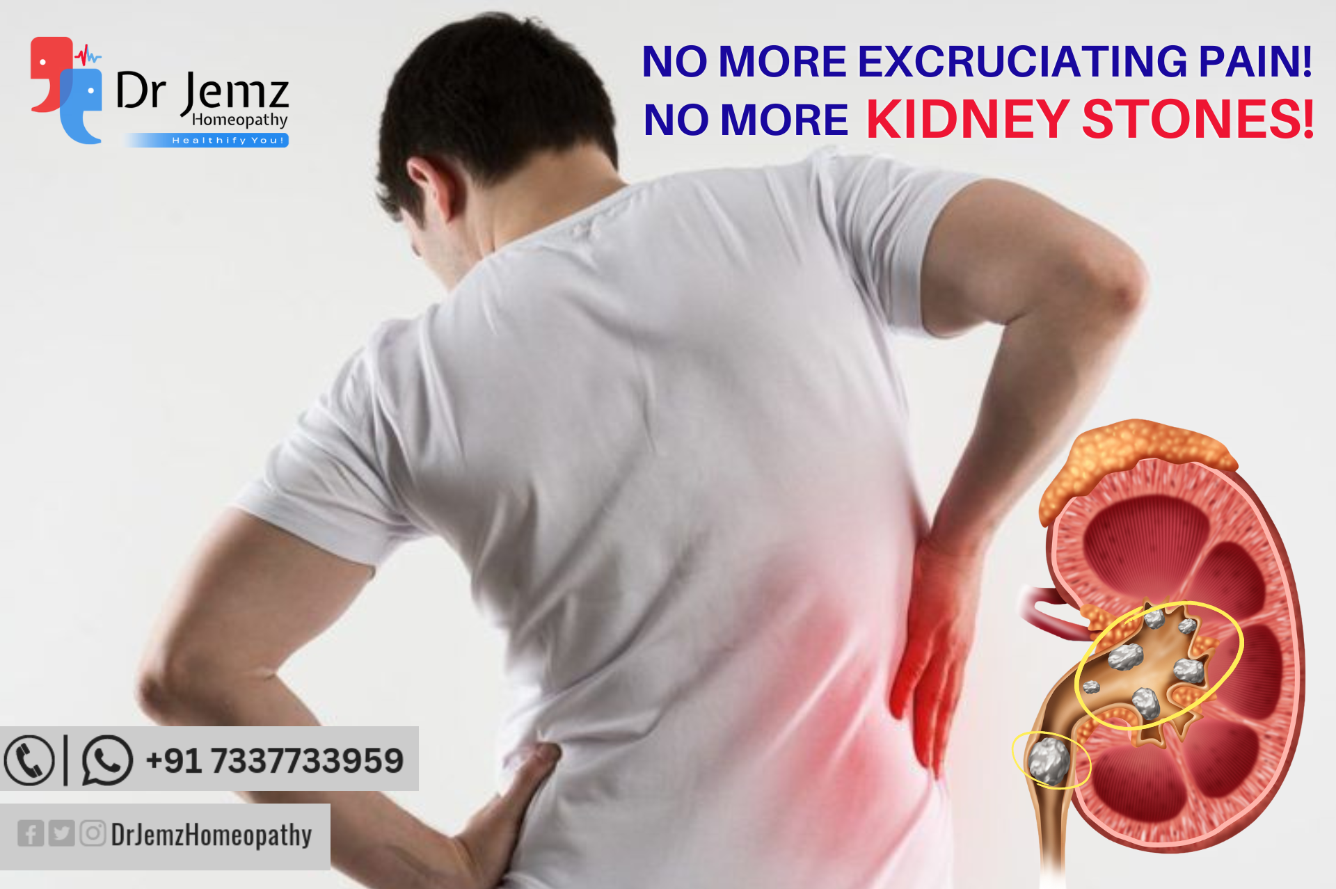 Crush your kidney stones with Homeopathy!