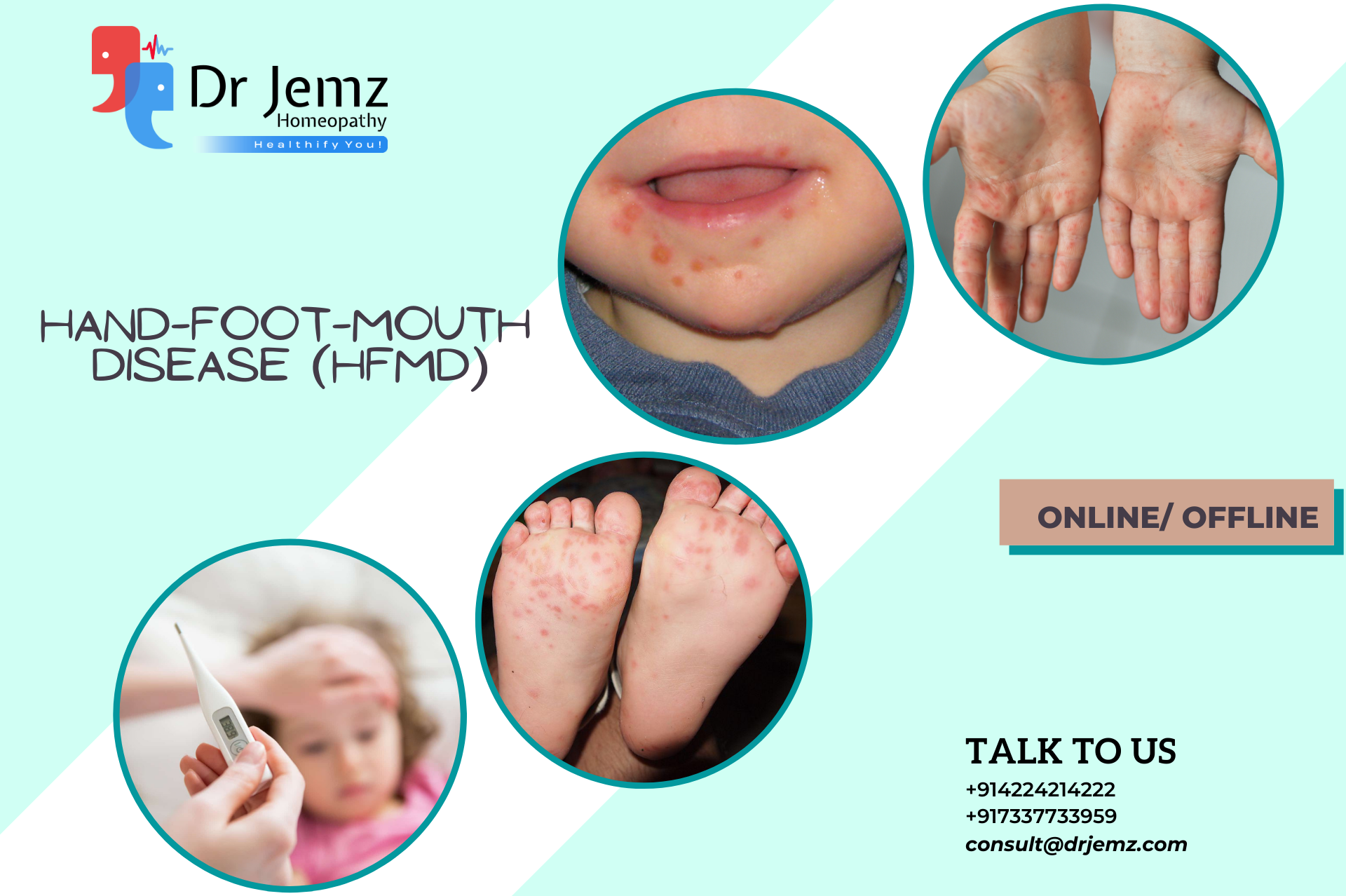 HOMEOPATHY AND HAND – FOOT – MOUTH DISEASE (HFMD)
